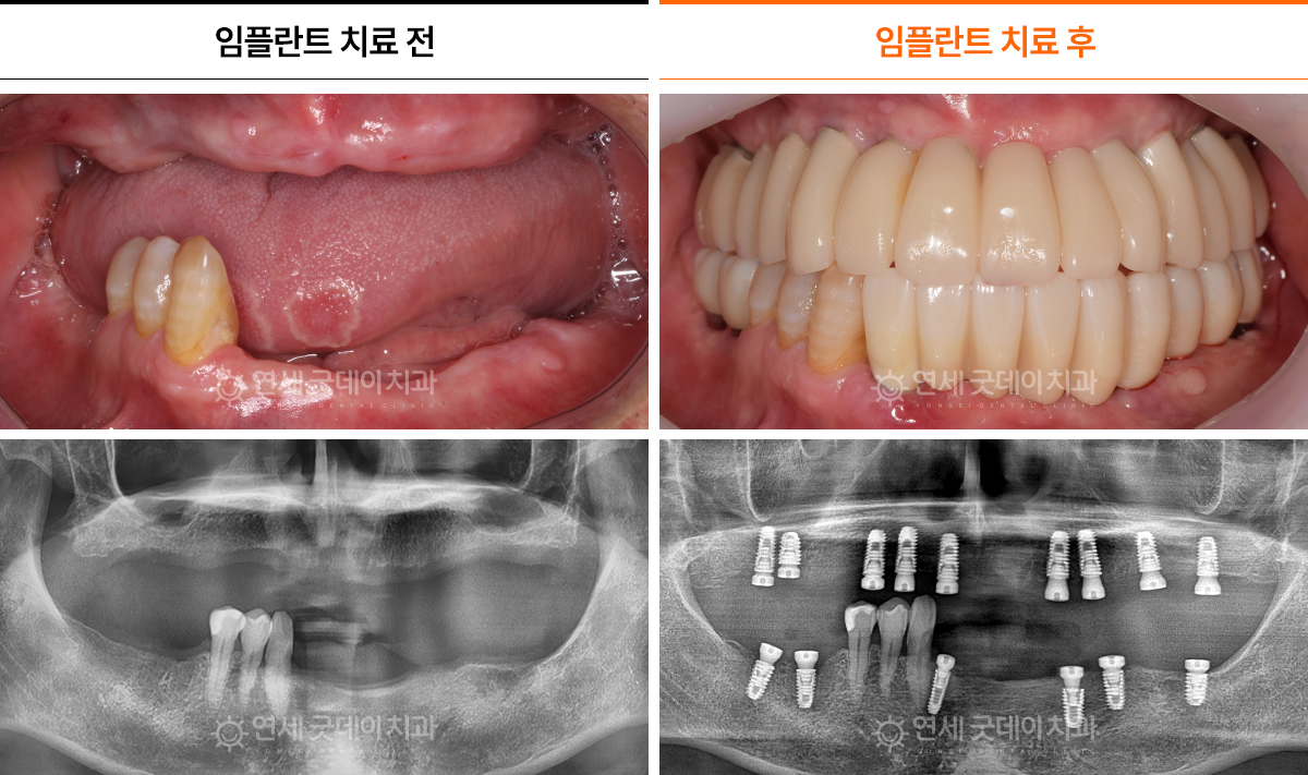 상_04