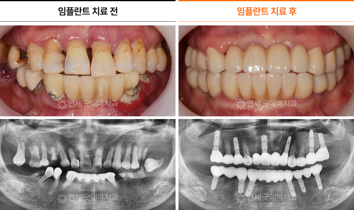 하_04