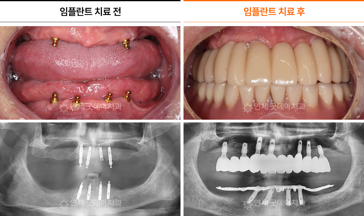 하_05