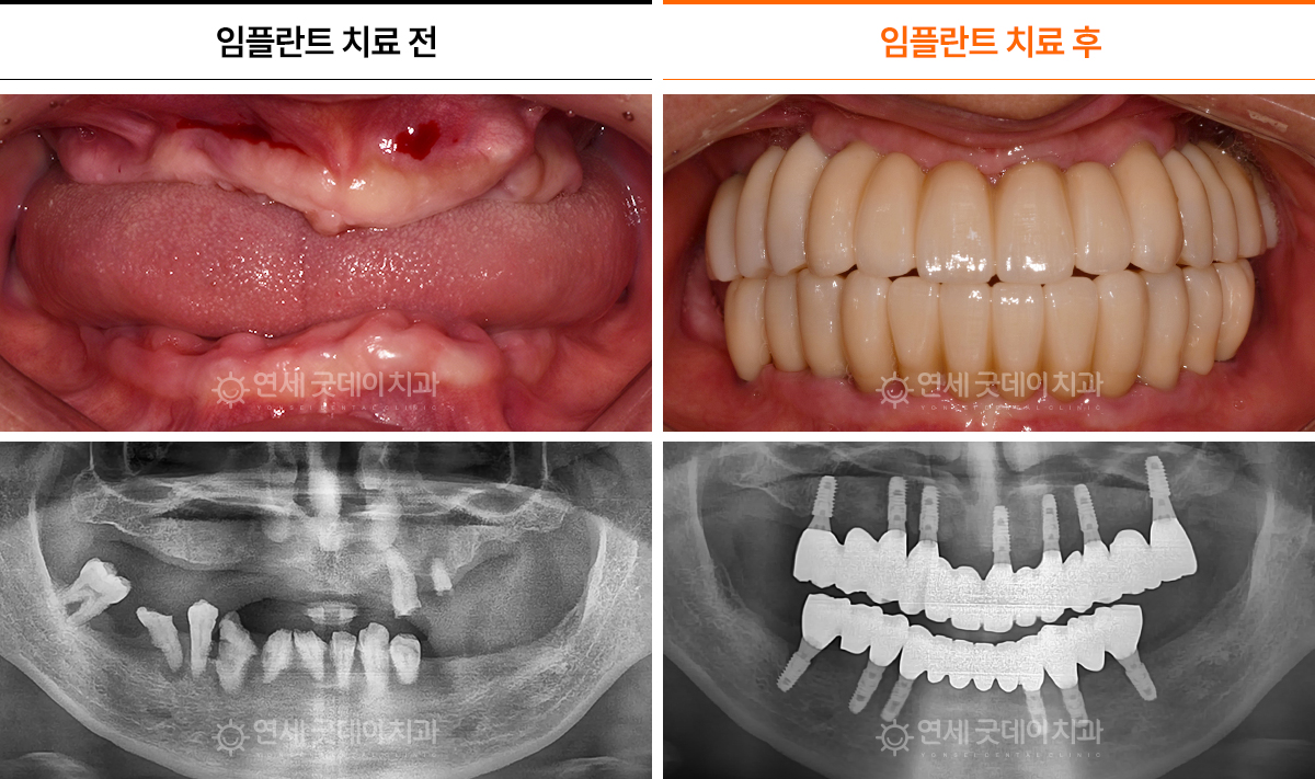 하_11