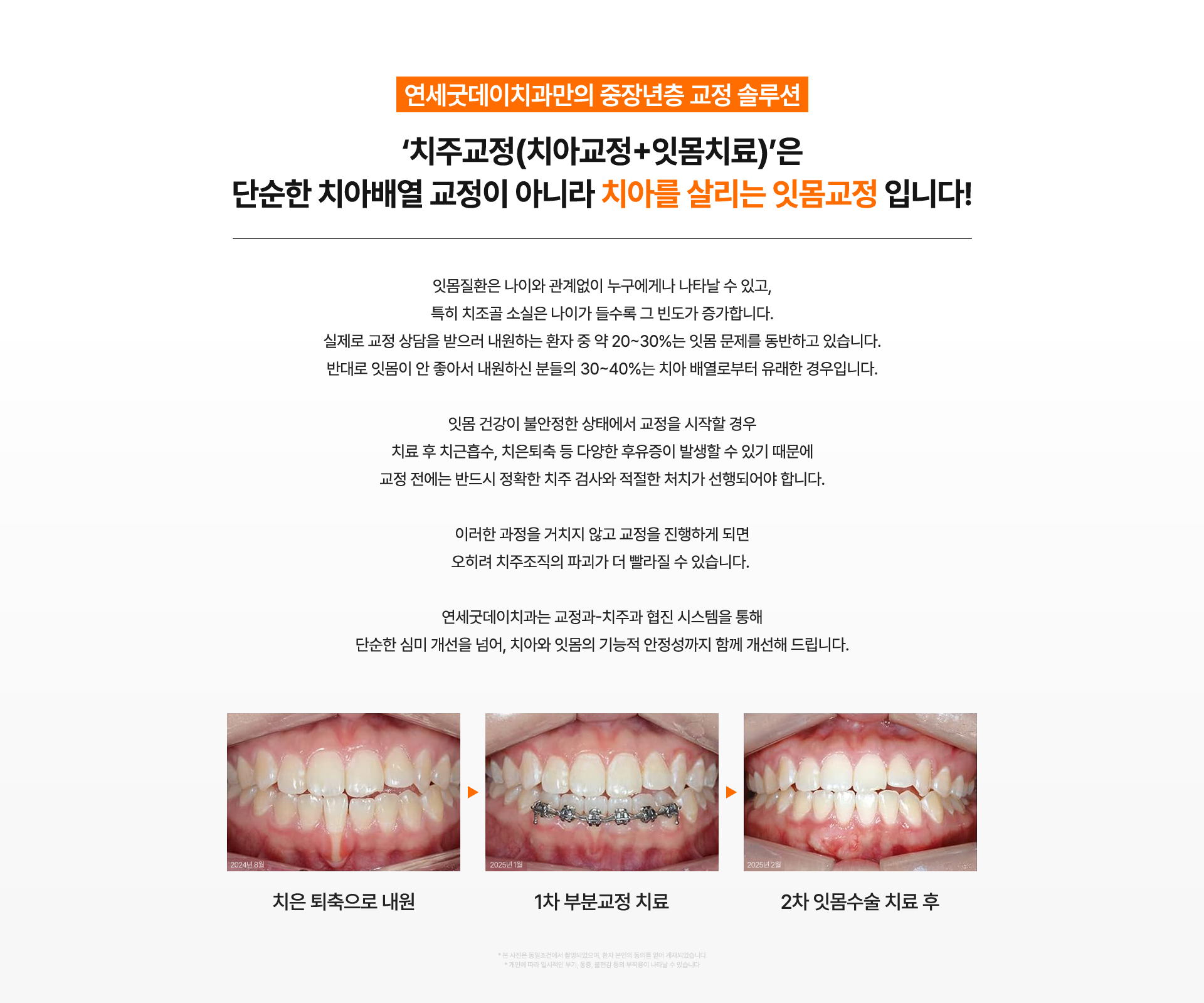 연세굿데이치과의 중장년층을 위한 맞춤 치주교정 솔루션 소개.