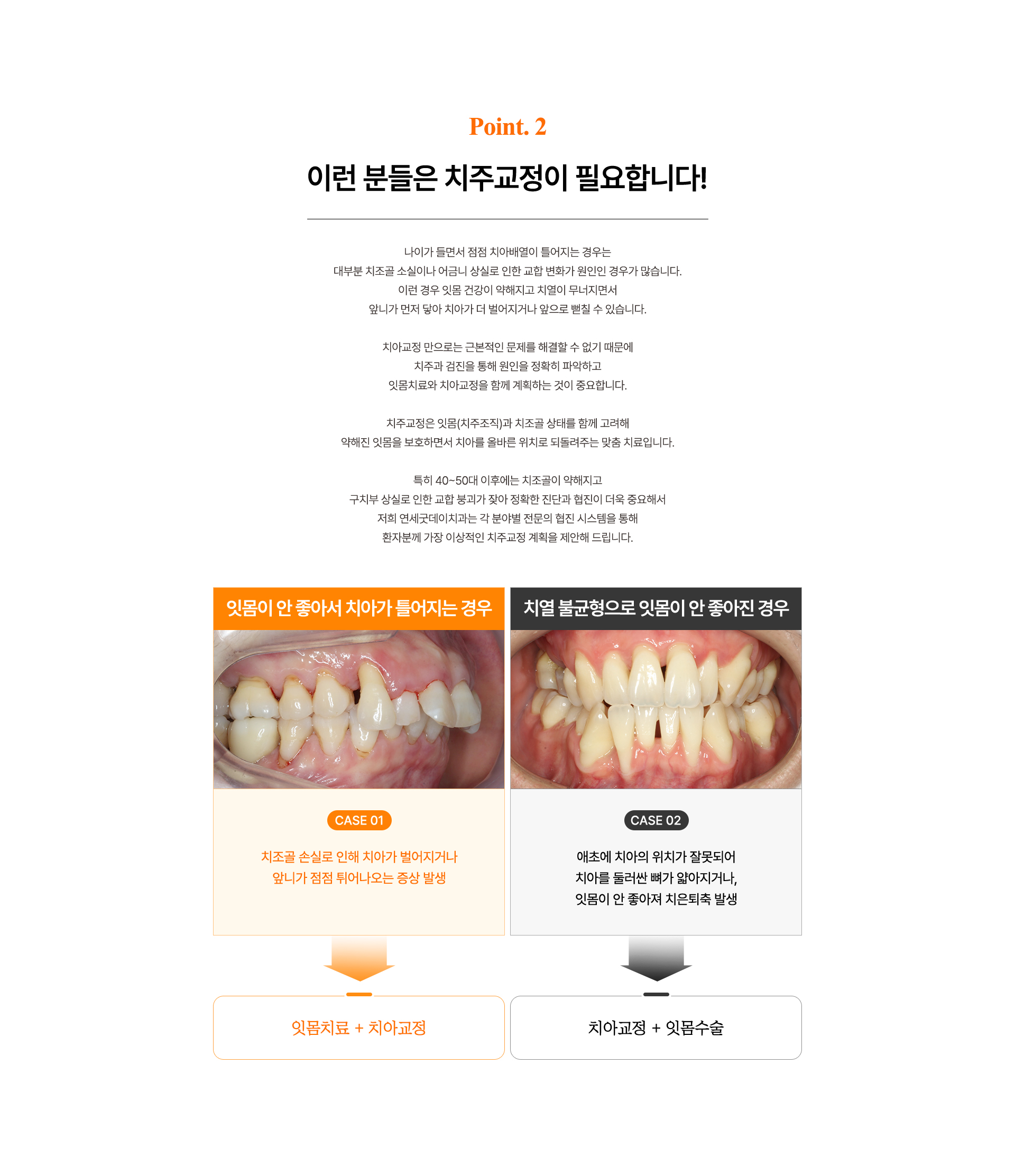 중장년층 치주교정에서 잇몸치료와 교정수술 방법을 비교 설명하는 도식.