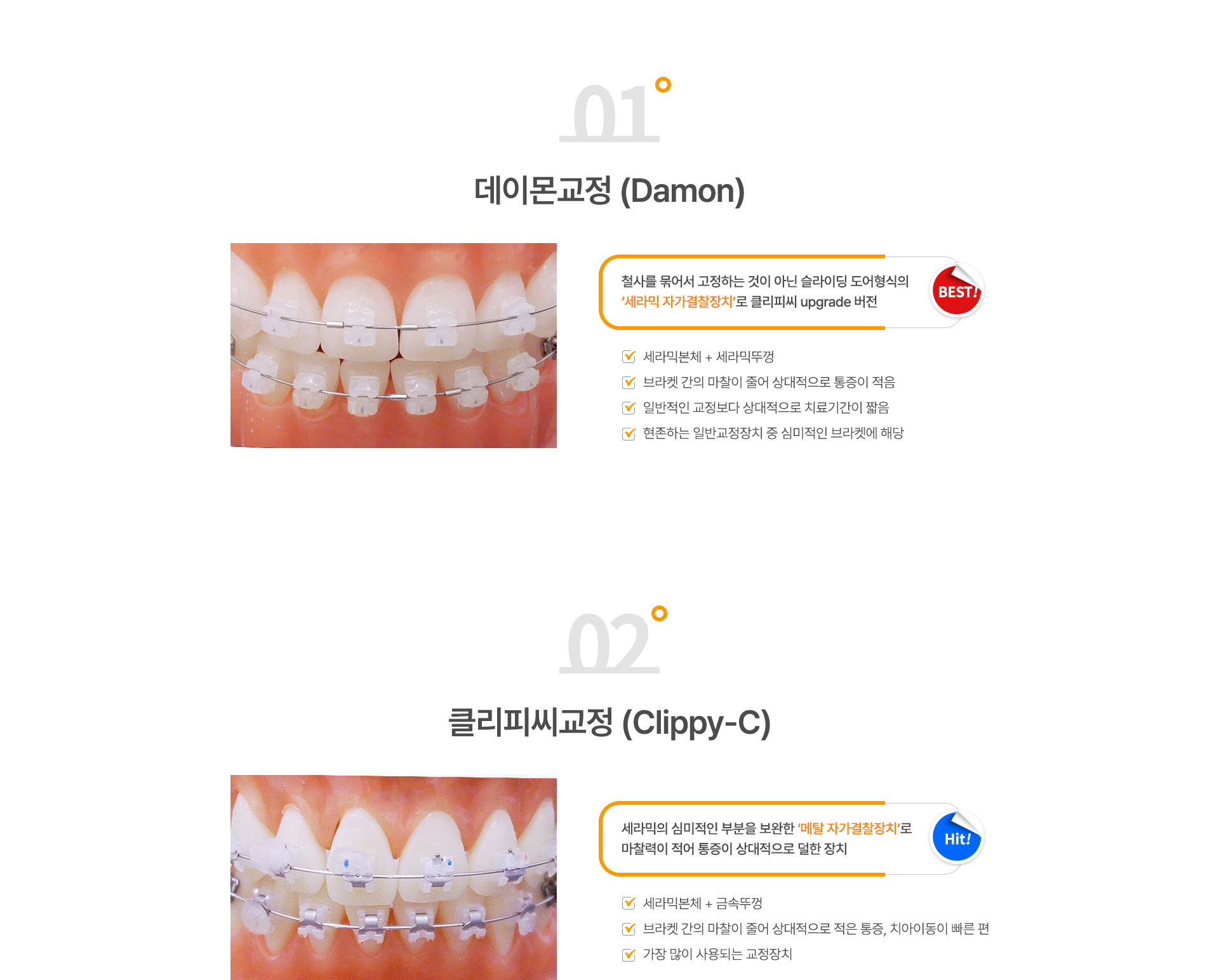 교정장치종류