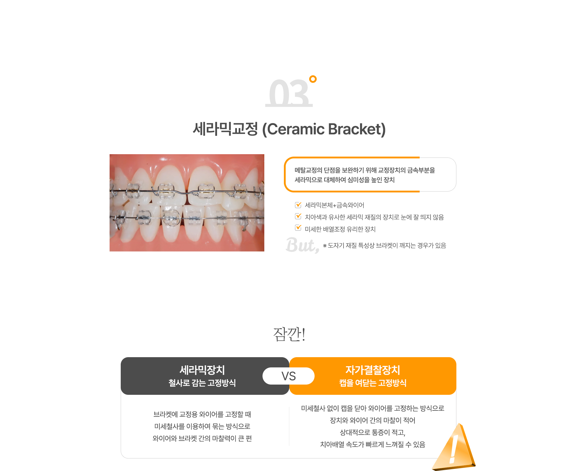 교정장치종류