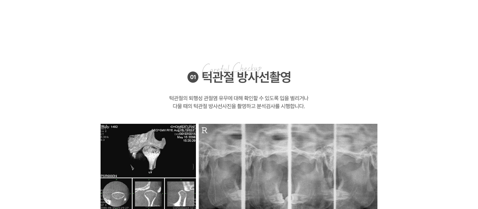 비수술치료법