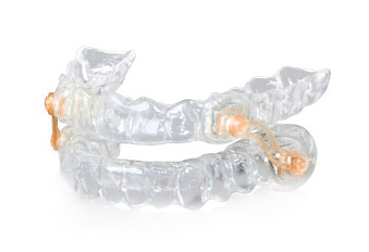 개방교합 턱관절교정