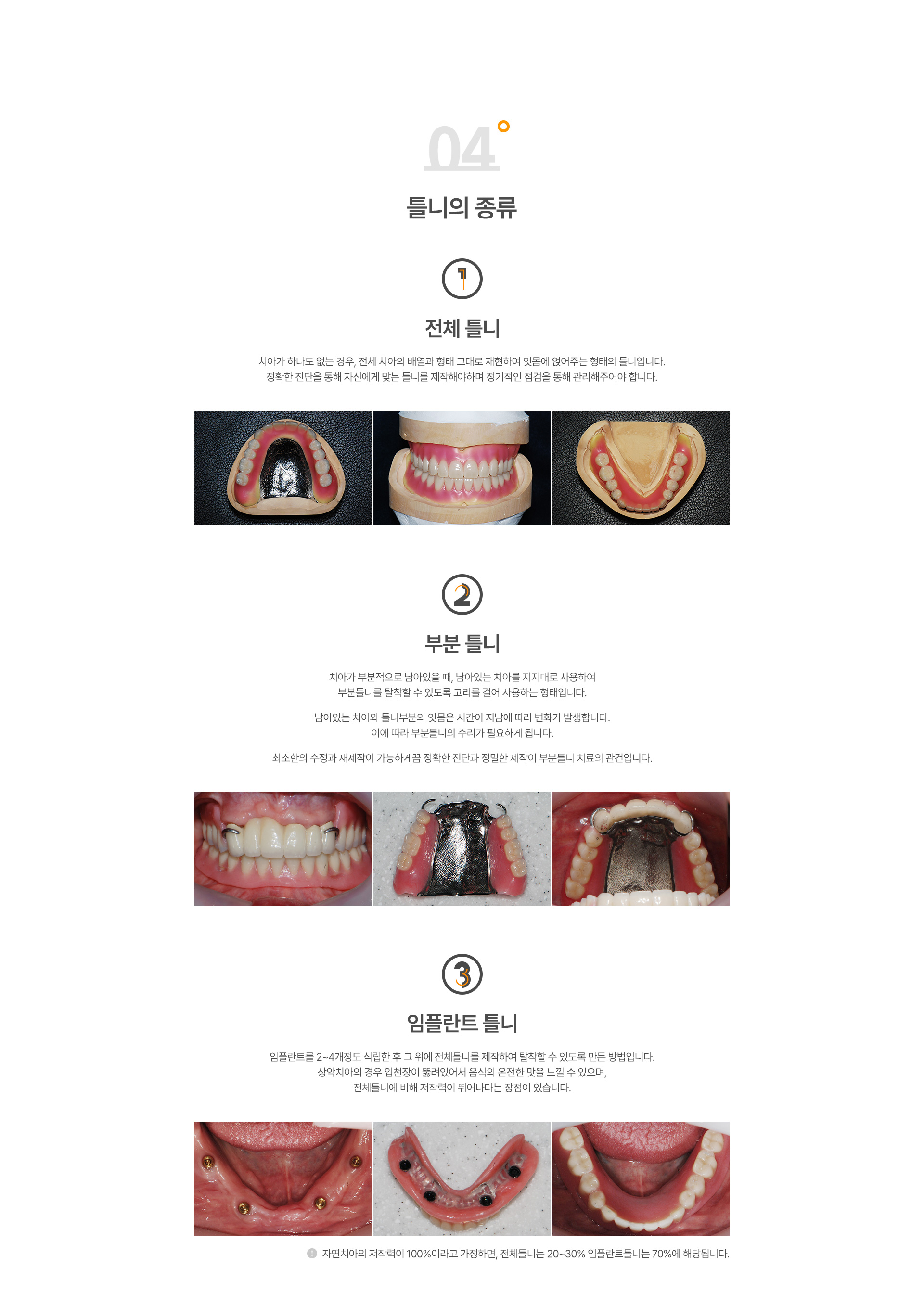 전체틀니/부분틀니