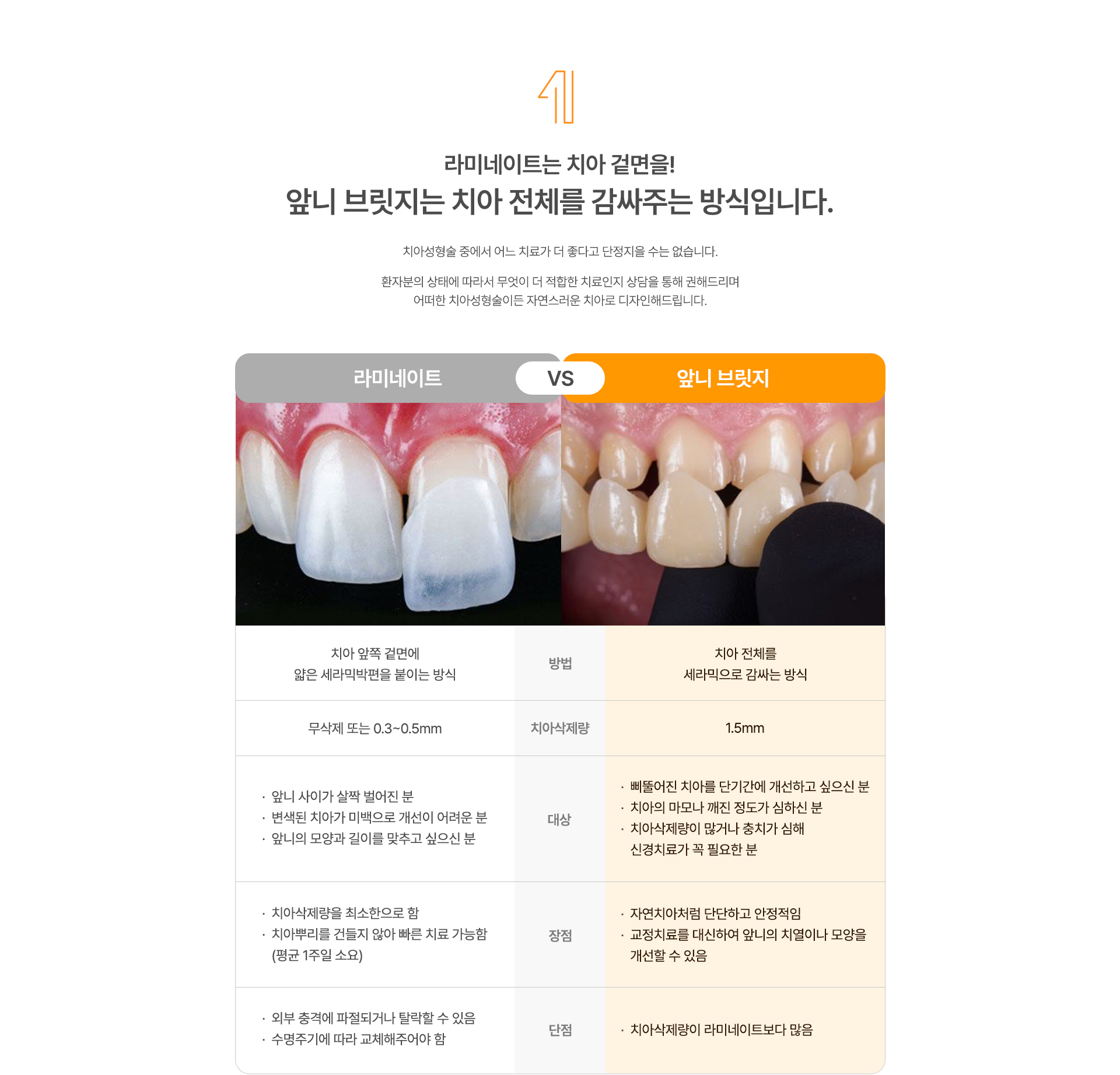 앞니브릿지와 라미네이트의 차이점