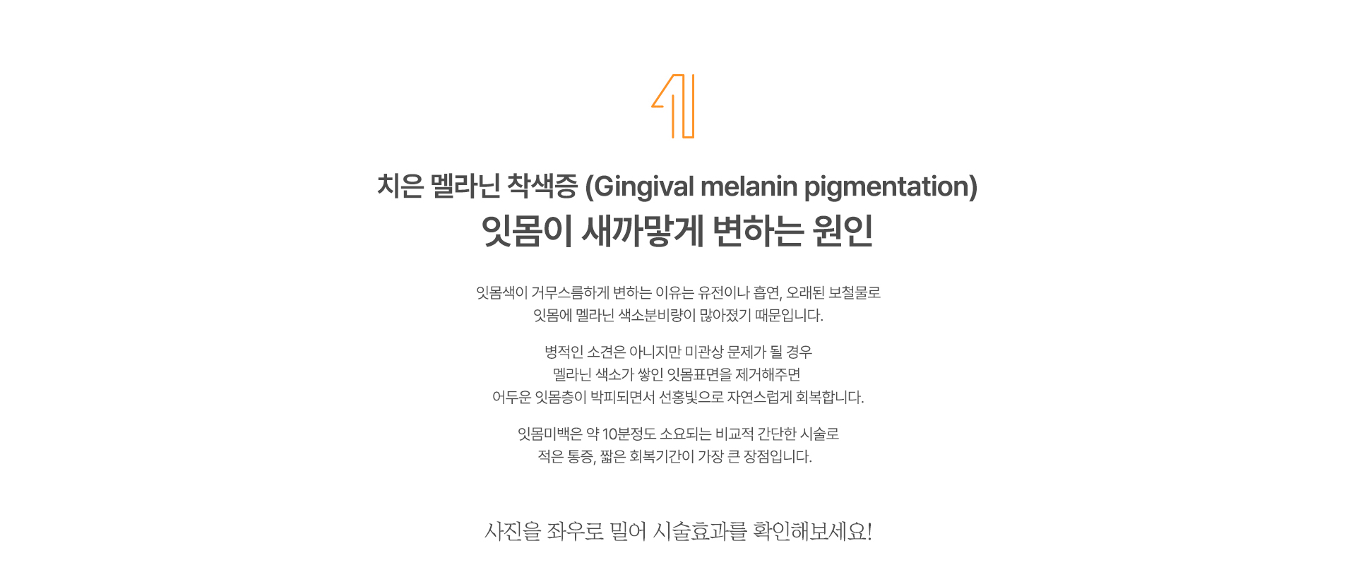 잇몸미백