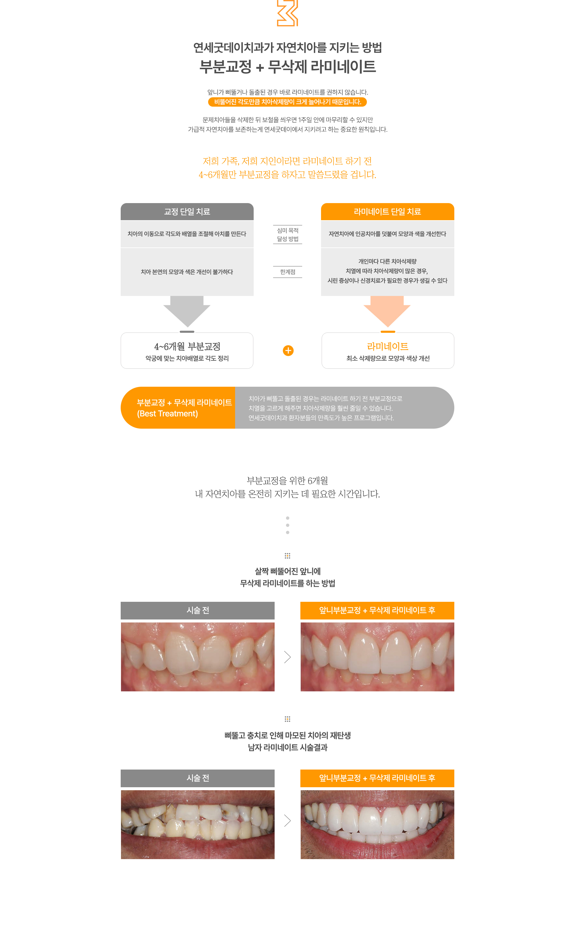 무삭제라미네이트